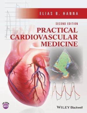 Practical Cardiovascular Medicine 2e